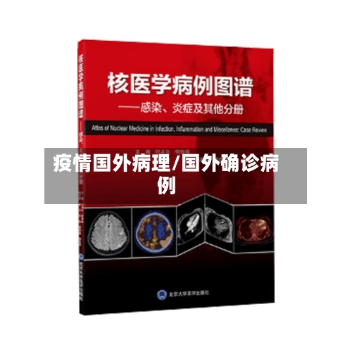疫情国外病理/国外确诊病例-第1张图片